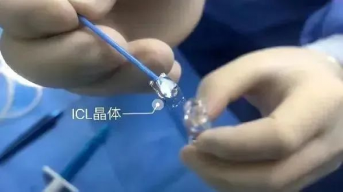 變身謠言“粉碎機”！濰坊眼科醫(yī)院員工集體ICL晶體植入摘鏡直播圓滿完成