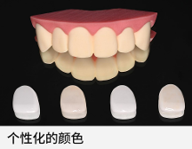 極薄強(qiáng)韌氧化鋯貼面技術(shù)，一款免磨牙貼面技術(shù)